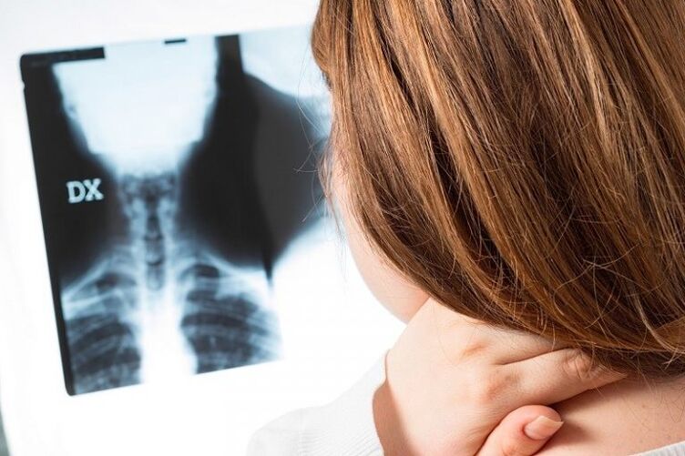X -Ray της αυχενικής περιοχής